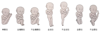逆子、胎位異常、灸、安産